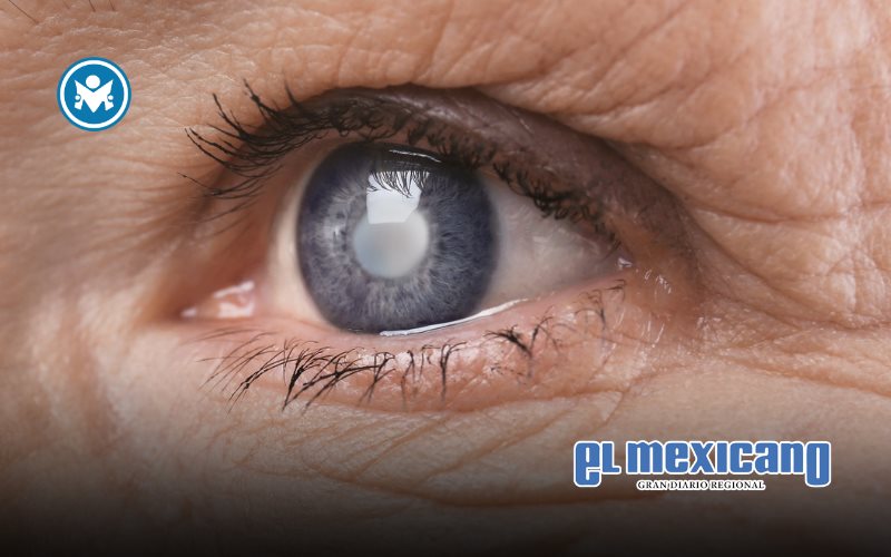 Factores de riesgo genéticos en glaucoma ¿por qué los antecedentes familiares son importantes?