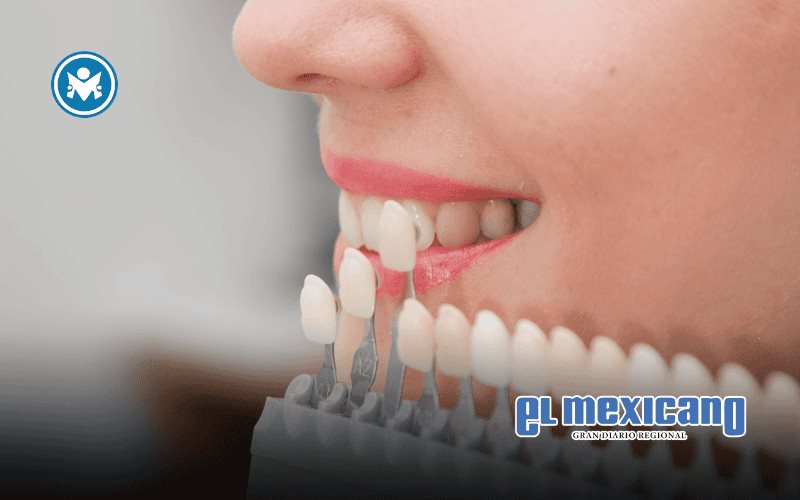 Salud dental: ¿porcelana o resina para el diseño de sonrisa?