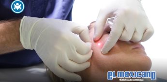 Así es Endolift, el láser sin cirugía que estimula la producción de colágeno en la piel Así es Endolift, el láser sin cirugía que estimula la producción de colágeno en la piel