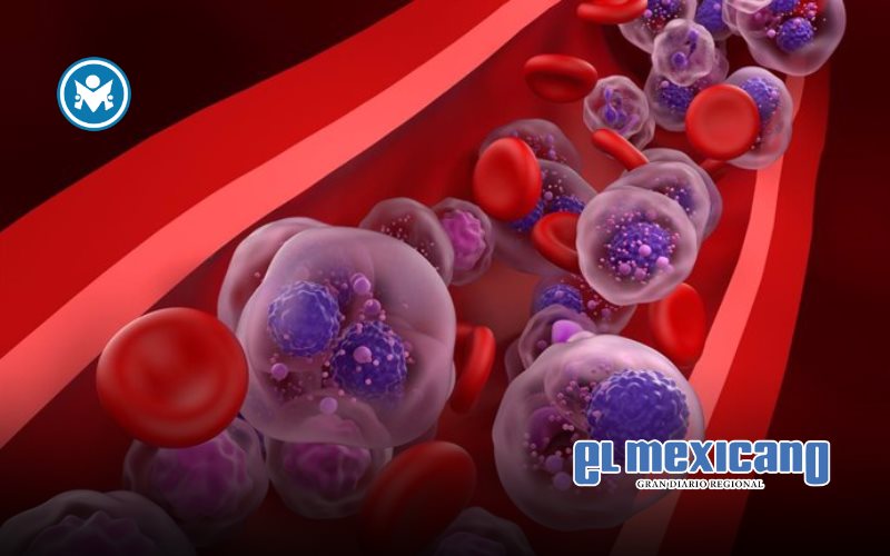 Cómo la innovación acelera el camino hacia una posible cura funcional del mieloma múltiple Cómo la innovación acelera el camino hacia una posible cura funcional del mieloma múltiple