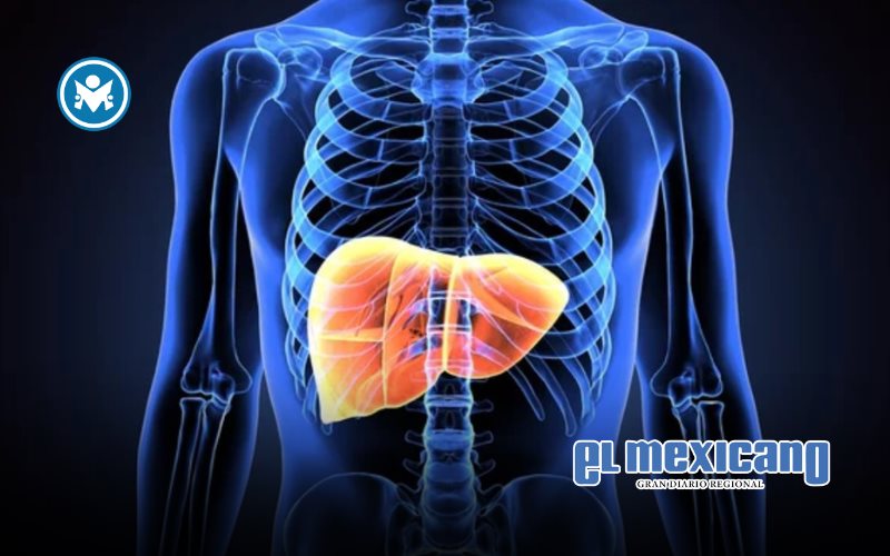 Sobrepeso y obesidad: principales factores de riesgo relacionados al desarrollo de esteatohepatitis asociada a disfunción metabólica