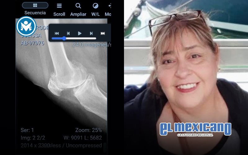 La artrosis, un mal de rodillas extendido entre adultos mayores como Julissa, en Mexicali La artrosis, un mal de rodillas extendido entre adultos mayores como Julissa, en Mexicali