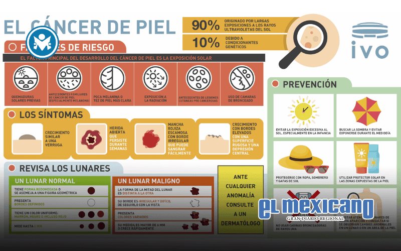 Recomienda Pro Oncavi uso diario de protector solar y prevenir el cáncer de piel