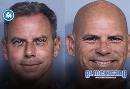 Maíz en riesgo por producción récord en EE.UU. Maíz en riesgo por producción récord en EE.UU.