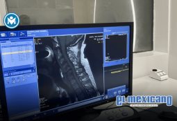 Arzobispo Francisco Moreno Barrón será sometido a tratamiento por cáncer Arzobispo Francisco Moreno Barrón será sometido a tratamiento por cáncer