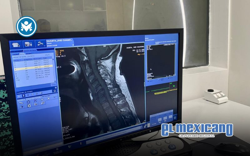 Ofrecen alternativa accesible y de calidad para estudios de imagenología dentro de Cruz Roja Ofrecen alternativa accesible y de calidad para estudios de imagenología dentro de Cruz Roja