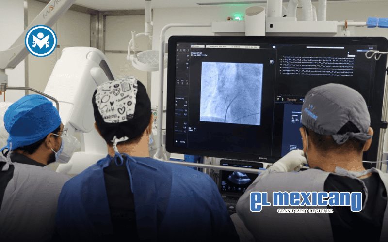 Primer procedimiento de ablación por campo pulsado se realiza con éxito en Yucatán Primer procedimiento de ablación por campo pulsado se realiza con éxito en Yucatán