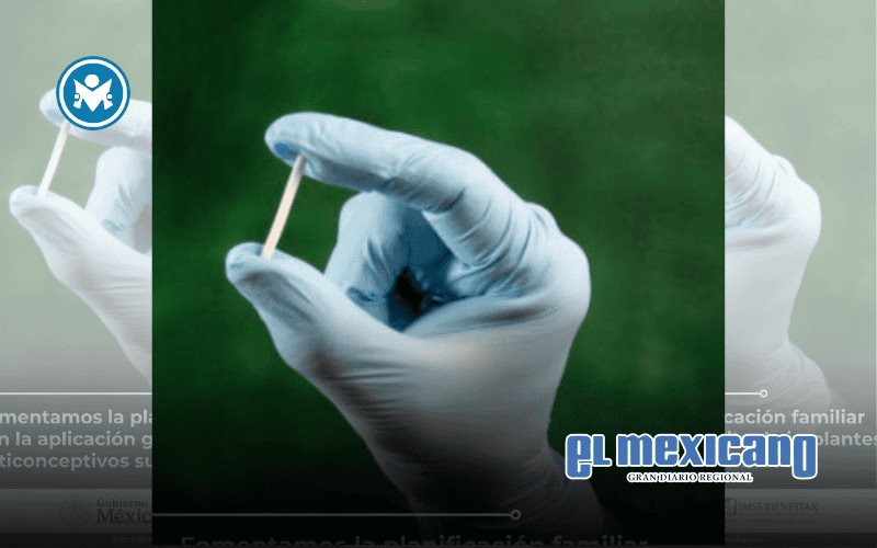 IMSS Bienestar fomenta la planificación familiar con la aplicación gratuita de implantes anticonceptivos subdérmicos