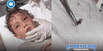 Niño en Cancún sufre insólito accidente: un cangrejo se metió en su oído