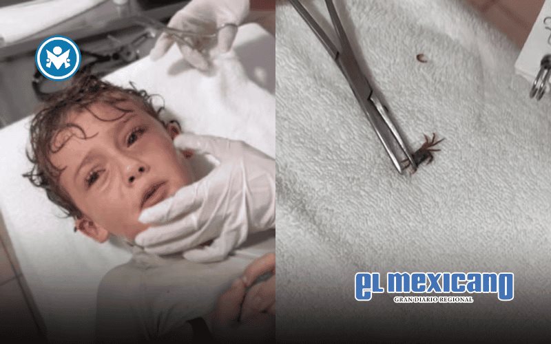 Niño en Cancún sufre insólito accidente: un cangrejo se metió en su oído