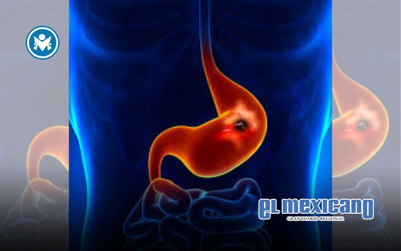 De lo invisible a lo urgente: la detección temprana del cáncer gástrico puede salvar vidas