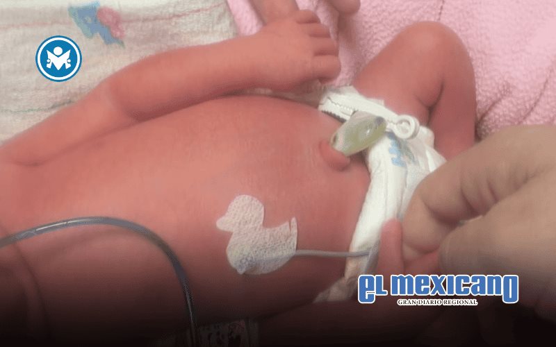 Beb&eacute; prematura lucha por su vida en Mexicali; familia pide apoyo econ&oacute;mico