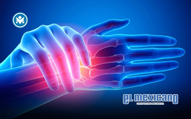 Amgen refuerza educación sobre enfermedades reumáticas en México