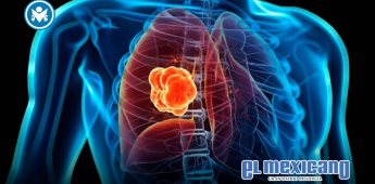 FDA otorga aprobación acelerada para terapia oral dirigida para cáncer de pulmón avanzado FDA otorga aprobación acelerada para terapia oral dirigida para cáncer de pulmón avanzado