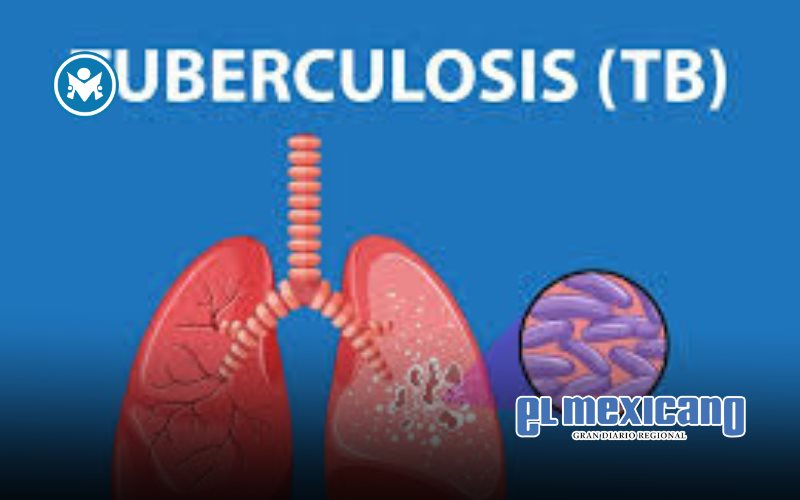 Solución capaz de identificar la tuberculosis en personas con diabetes antes de que se manifieste Solución capaz de identificar la tuberculosis en personas con diabetes antes de que se manifieste