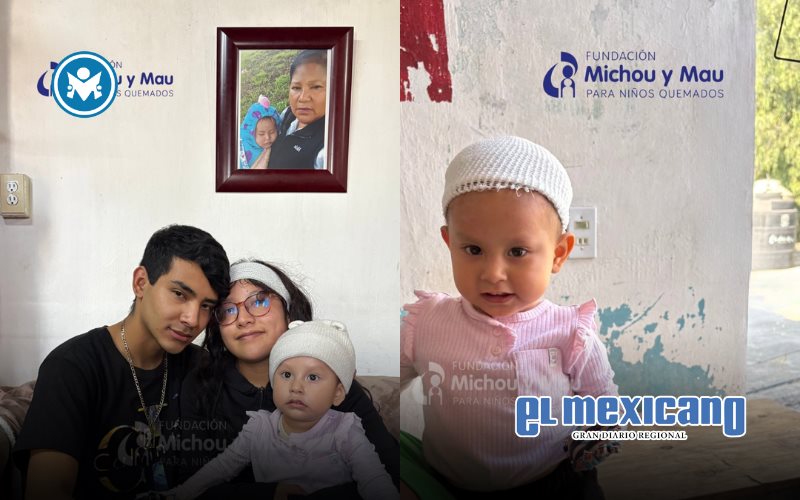 Jazlyn Azulet regresa a México tras tratamiento por graves quemaduras en EU