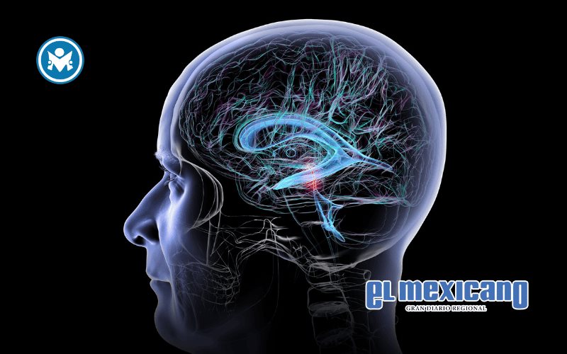 Fuga de líquido en el cerebro que puede imitar al Alzheimer Fuga de líquido en el cerebro que puede imitar al Alzheimer