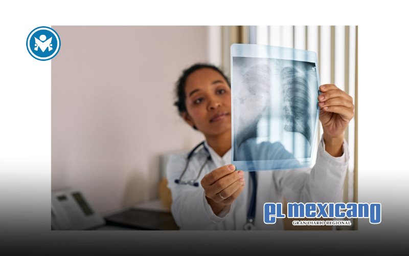 Nuevo avance contra la Fibrosis Pulmonar Idiopática: FDA aprueba tratamiento tras una década Nuevo avance contra la Fibrosis Pulmonar Idiopática: FDA aprueba tratamiento tras una década