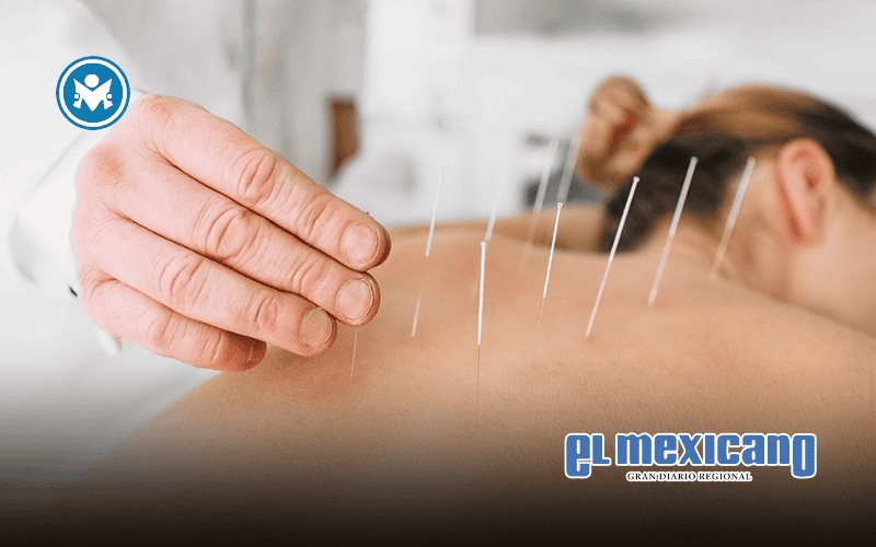 Todo lo que querías saber sobre la acupuntura Todo lo que querías saber sobre la acupuntura