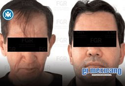 Prepara tu sistema inmunol&oacute;gico para la &eacute;poca de fr&iacute;o