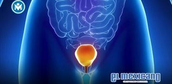 Fomentan detecciones oportunas de cáncer vesical Fomentan detecciones oportunas de cáncer vesical