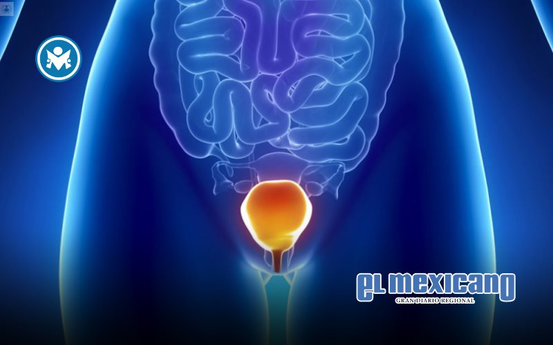 Fomentan detecciones oportunas de cáncer vesical Fomentan detecciones oportunas de cáncer vesical