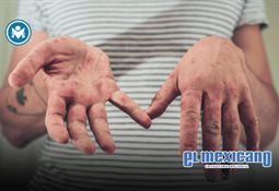 M&eacute;xico tiene dos meses para contener el sarampi&oacute;n o perder estatus de pa&iacute;s libre