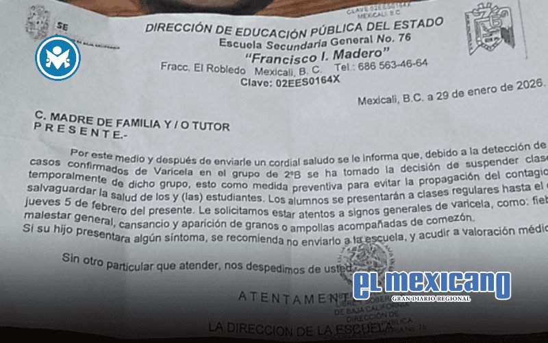 Brote de varicela obliga a suspender clases en la Secundaria General No. 76 Francisco I. Madero