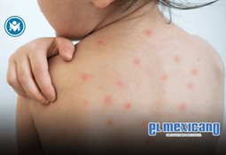 Bichectomia est&eacute;tica: siempre por indicaci&oacute;n m&eacute;dica y no por tendencias virales