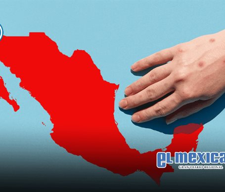 M&eacute;xico enfrenta aumento de sarampi&oacute;n: Hospitales MAC llama a atenci&oacute;n temprana