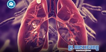 La tuberculosis, un reto vigente: la vacunaci&oacute;n y la innovaci&oacute;n, claves para 2035