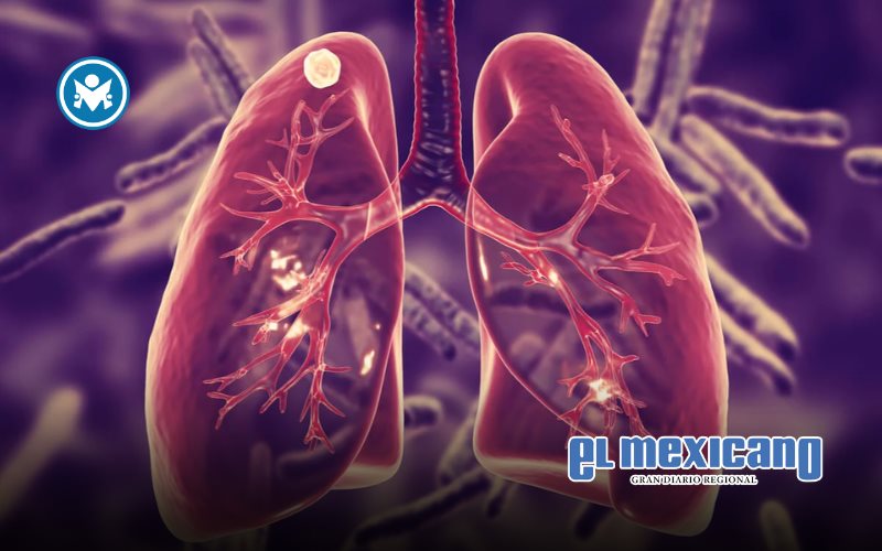 La tuberculosis, un reto vigente: la vacunación y la innovación, claves para 2035 La tuberculosis, un reto vigente: la vacunación y la innovación, claves para 2035