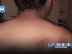 Estudiante de secundaria en la colonia Libertad sufre quemaduras tras ataque con sosa cáustica Estudiante de secundaria en la colonia Libertad sufre quemaduras tras ataque con sosa cáustica