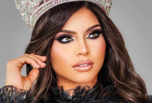 Galer&iacute;a Imagen 2