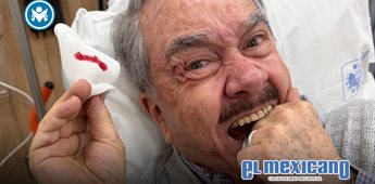 Pedro Sola sufre caída por un bache y termina hospitalizado; reportan que se encuentra estable Pedro Sola sufre caída por un bache y termina hospitalizado; reportan que se encuentra estable