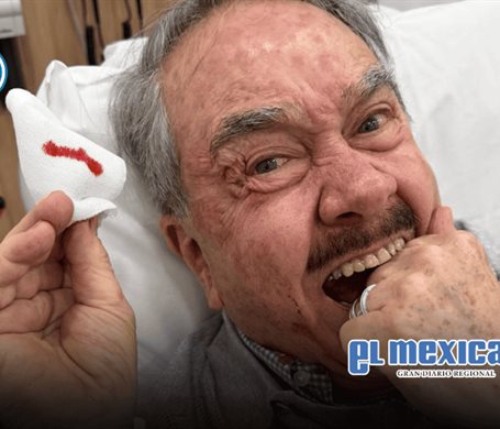 Pedro Sola sufre caída por un bache y termina hospitalizado; reportan que se encuentra estable Pedro Sola sufre caída por un bache y termina hospitalizado; reportan que se encuentra estable