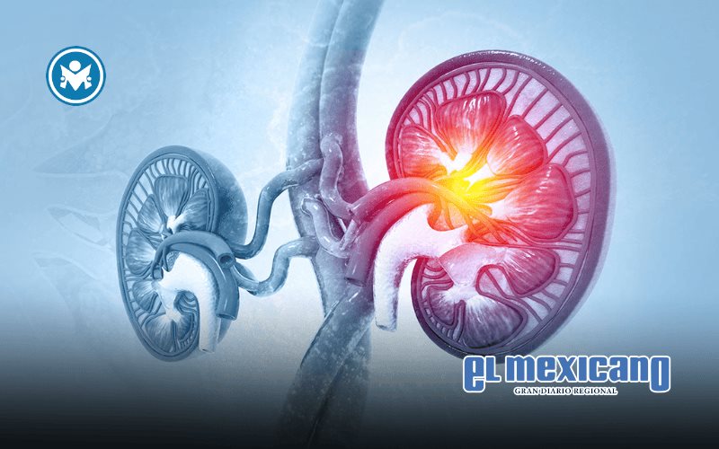 Innovador método quirúrgico amplía opciones de trasplante renal en pacientes de alto riesgo Innovador método quirúrgico amplía opciones de trasplante renal en pacientes de alto riesgo