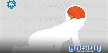 S&iacute;ndrome de Dravet: una epilepsia rara que desaf&iacute;a el diagn&oacute;stico temprano y el tratamiento en la infancia