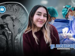 &iquest;Qu&eacute; es la Malformaci&oacute;n de Arnold-Chiari? La enfermedad que llev&oacute; a una joven de Tijuana a una cirug&iacute;a cerebral