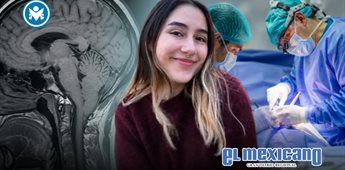 &iquest;Qu&eacute; es la Malformaci&oacute;n de Arnold-Chiari? La enfermedad que llev&oacute; a una joven de Tijuana a una cirug&iacute;a cerebral
